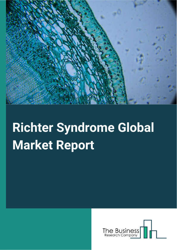 Global Richter Syndrome Market Report 2025