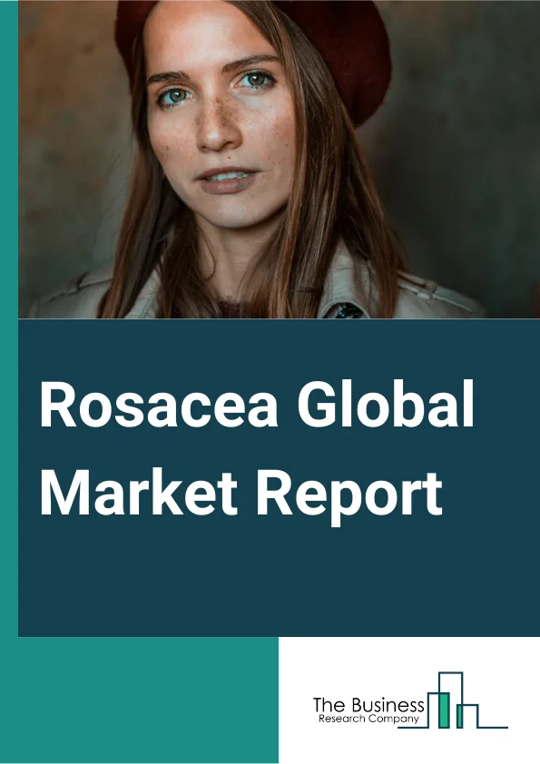 Rosacea Global Market Report 2024 