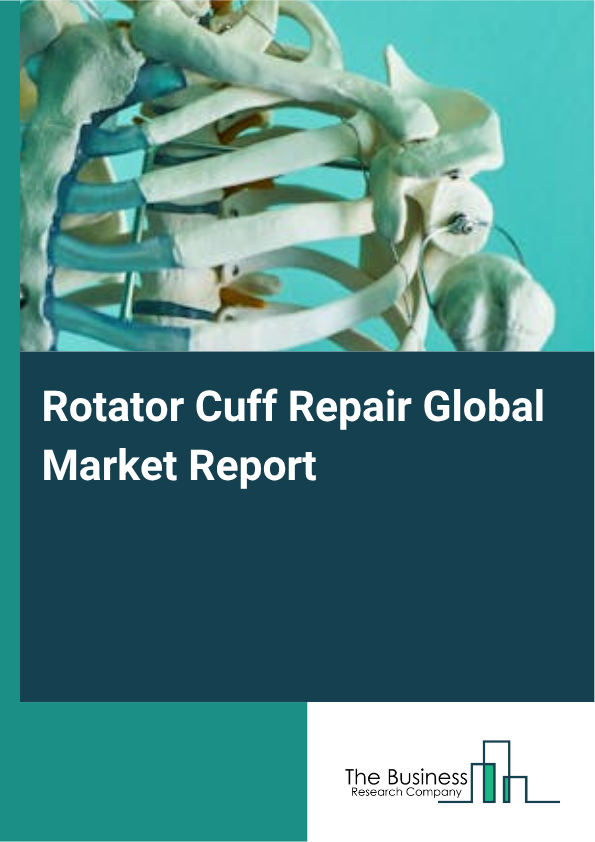 Global Rotator Cuff Repair Market Report 2025
