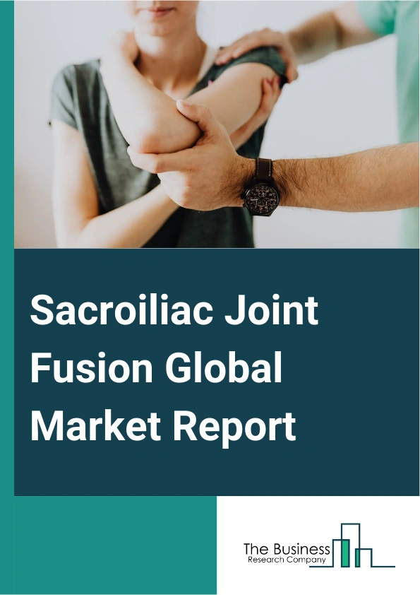 Global Sacroiliac Joint Fusion Market Report 2025