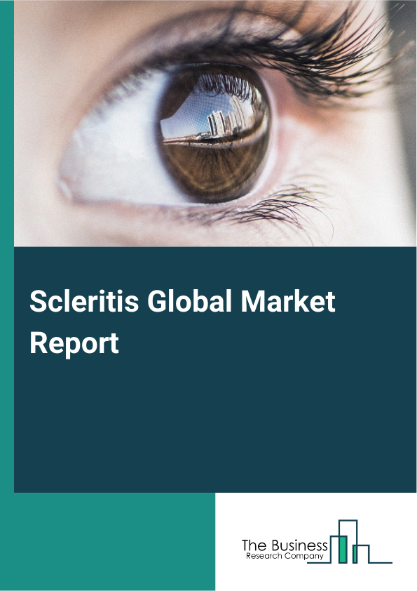 Global Scleritis Market Report 2025