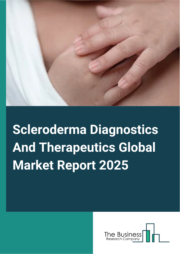 Global Scleroderma Diagnostics And Therapeutics Market Report 2025