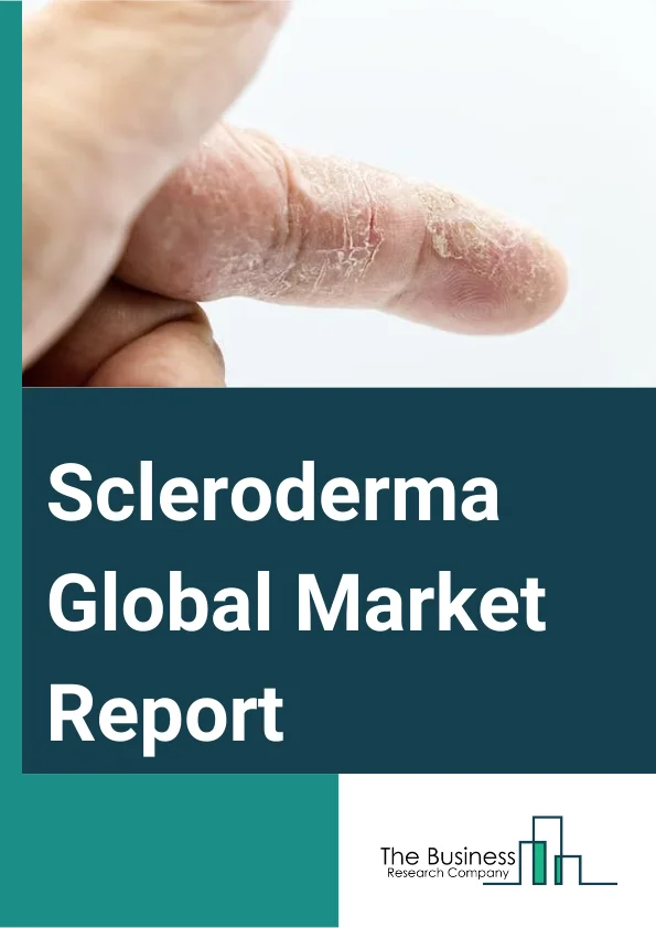 Scleroderma