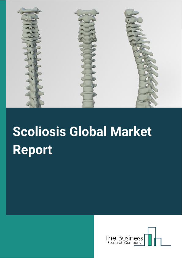 Global Scoliosis Market Report 2025