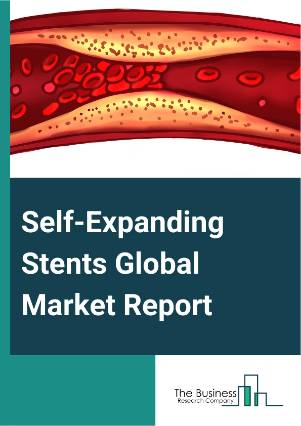 Self-Expanding Stents Global Market Report 2025 – By Product Type (Gastrointestinal Self-Expanding Stents, Carotid Self-Expanding Stents, Endovascular Self-Expandable Stents, Other Product Types), By Applications (Fem-Pop Artery Stents, Iliac Artery Stents, Carotid Artery Stents, Biliary Stents, Other Applications), By End-Users (Hospitals, Ambulatory Surgical Centers, Other End-Users) – Market Size, Trends, And Global Forecast 2025-2034