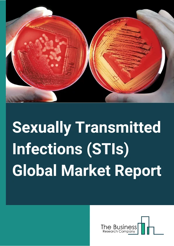 Sexually Transmitted Infections (STIs) Global Market Report 2025 – By Type (Human Immunodeficiency Virus (HIV), Human Papilloma Virus (HPV), Gonorrhea, Syphilis, Other Types), By Treatment (Antibiotics, Antiviral), By Location Of Testing (Laboratory Testing, Point-Of-Care (POC) Testing), By Route Of Administration (Oral, Parenteral, Other Route Of Administration), By End-Users (Hospitals, Specialty Clinics, Homecare, Other End-Users) – Market Size, Trends, And Global Forecast 2025-2034