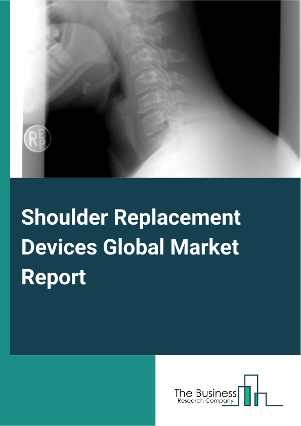 Global Shoulder Replacement Devices Market Report 2025