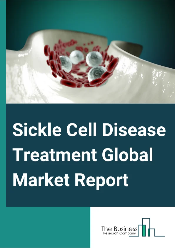 Sickle Cell Disease Treatment Global Market Report 2024 