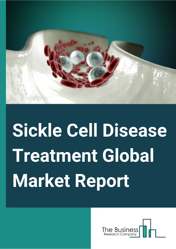Sickle Cell Disease Treatment Global Market Report 2025 – By Treatment Modality (Blood Transfusion, Pharmacotherapy, Bone Marrow Transplant), By Disease Type (Sickle Cell Anemia, Hemoglobin Sickle C Disease (HbSC), Other Disease Types), By Route Of Administration (Oral, Parenteral), By End-User (Hospitals, Specialty Clinics, Other End-Users) – Market Size, Trends, And Global Forecast 2025-2034