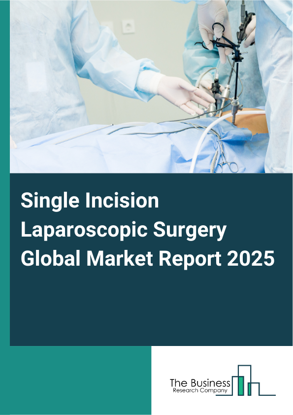 Global Single Incision Laparoscopic Surgery Market Report 2025 