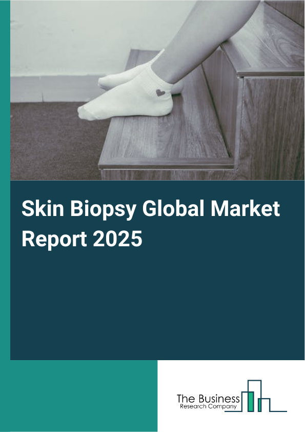 Global Skin Biopsy Market Report 2025