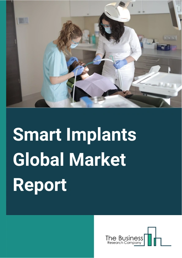 Smart Implants Global Market Report 2025 – By Type (Orthopedic Implants, Cardiovascular Implants, Dental Implants, Cosmetic Implants, Other Types), By Surgery (Open Surgery, Minimally Invasive Surgery), By Application (Knee And Hip Arthroplasty, Spine Fusion, Stents, Intraocular Lens, Pacing Devices), By End-User (Hospitals, Ambulatory Surgical Centers, Specialty Clinics, Other End-Users) – Market Size, Trends, And Global Forecast 2025-2034