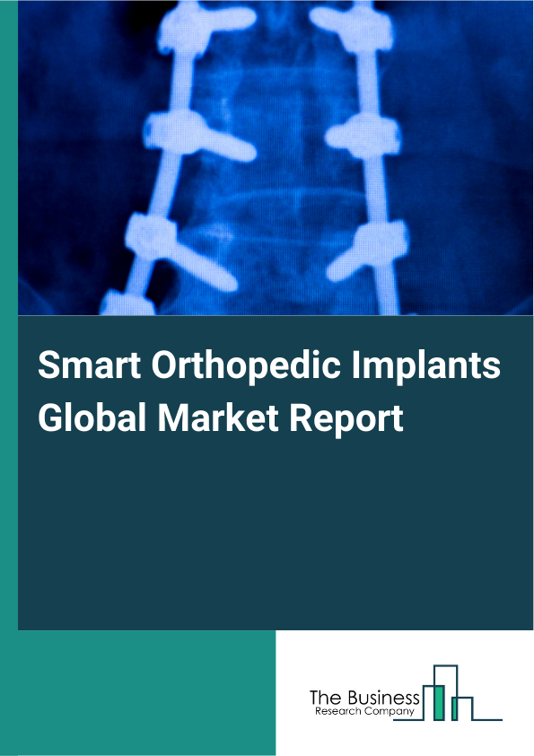 Global Smart Orthopedic Implants Market Report 2025
