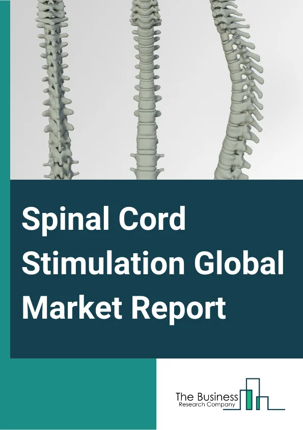 Spinal Cord Stimulation Global Market Report 2024 – By Product (Rechargeable, Non-rechargeable), By Application (Failed Back Surgery Syndrome (FBSS), Degenerative Disc Disease (DDD), Complex Regional Pain Syndrome (CRPS), Arachnoiditis, Other Disease Indications), By End User (Hospitals, Ambulatory Surgery Centers, Specialty Clinics) – Market Size, Trends, And Global Forecast 2024-2033