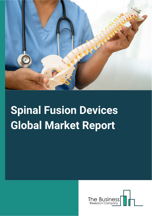 Spinal Fusion Devices