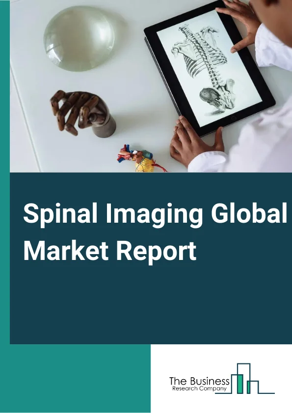 Spinal Imaging Global Market Report 2025 – By Product (X-Ray, CT, MRI, Ultrasound), By Application (Spinal Infection, Vertebral Fractures, Spinal Cancer, Spinal Cord and Nerve Compressions, Other Applications), By End-User (Hospital, Diagnostic Imaging Center, Ambulatory Care Center) – Market Size, Trends, And Global Forecast 2025-2034
