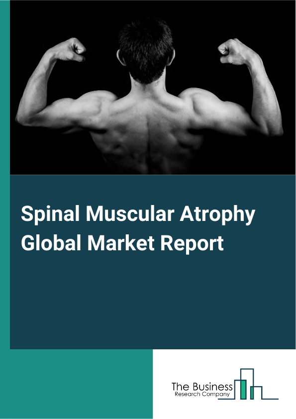 Global Spinal Muscular Atrophy Market Report 2025