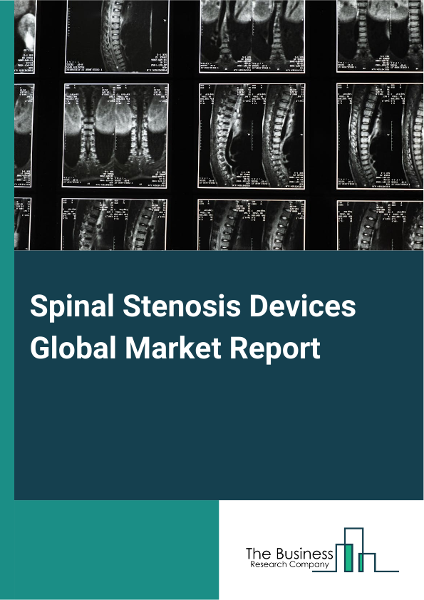 Global Spinal Stenosis Devices Market Report 2025