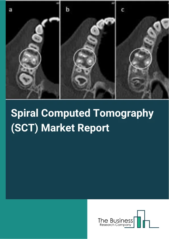 Spiral Computed Tomography (SCT) Market Report Infographic Image