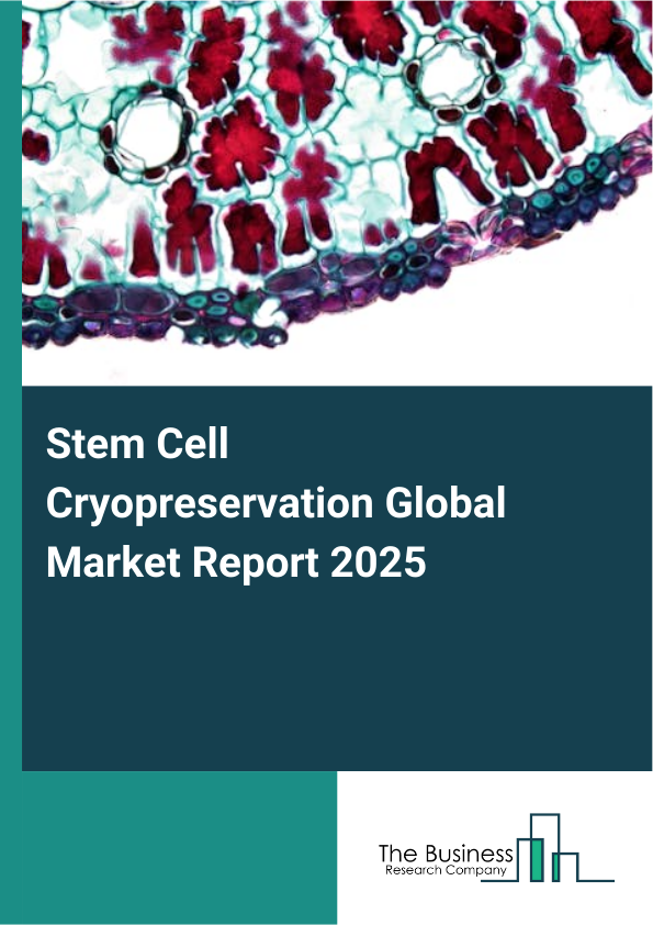 Global Stem Cell Cryopreservation Market Report 2025