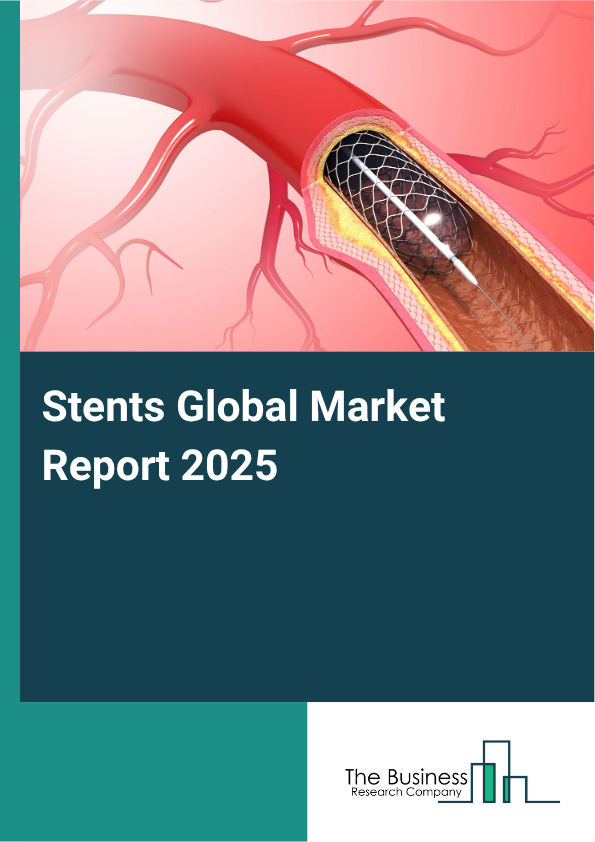 Global Stents Market Report 2025