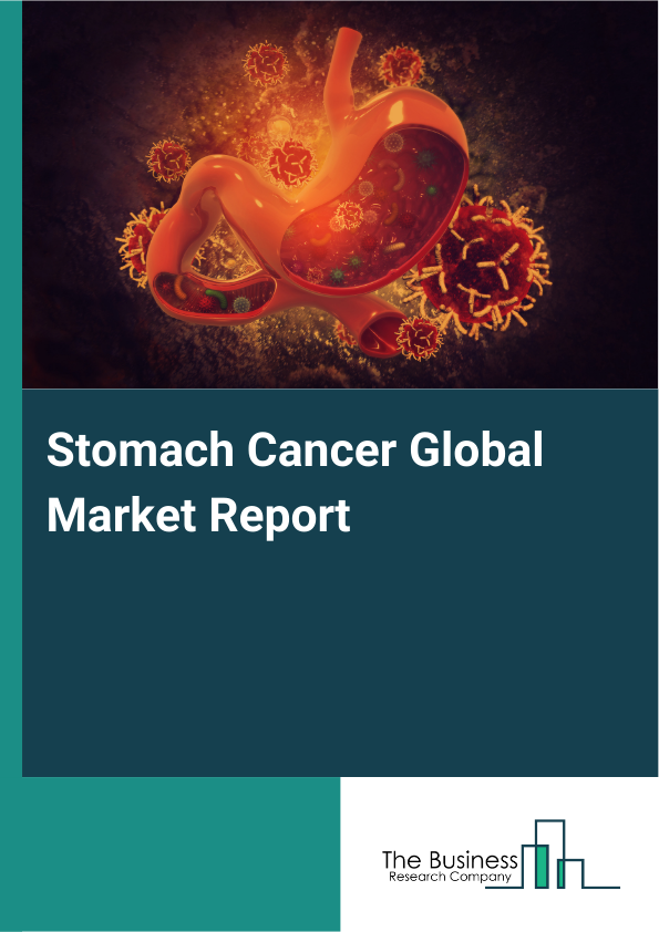 Global Stomach Cancer Market Report 2025