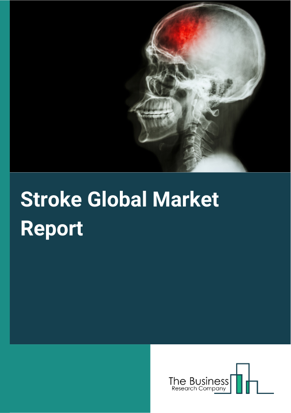 Global Stroke Market Report 2025