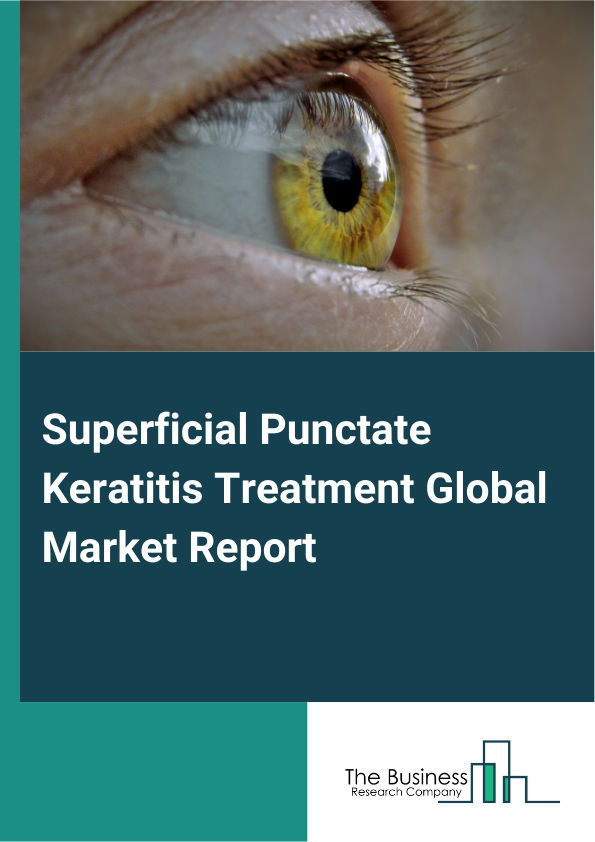 Global Superficial Punctate Keratitis Treatment Market Report 2025 