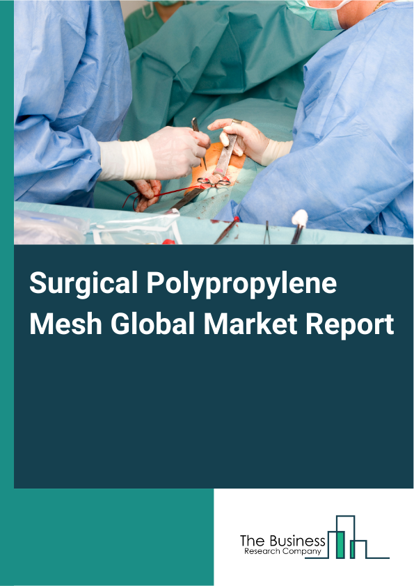 Global Surgical Polypropylene Mesh Market Report 2025