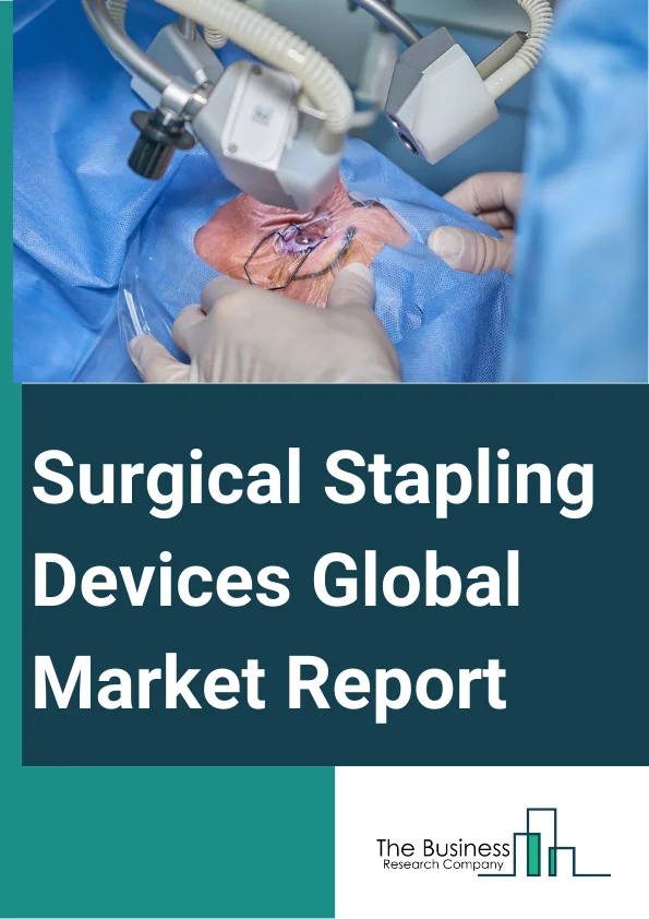 Surgical Stapling Devices Global Market Report 2025 – By Product (Powered, Manual), By Surgery Type (Open Surgery, Laparoscopic Surgery), By Application (Gynecology Surgery, Urology Surgery, General Surgery, Other Applications), By End-User (Hospitals, Ambulatory Surgical Centers, Other End -Users) – Market Size, Trends, And Global Forecast 2025-2034