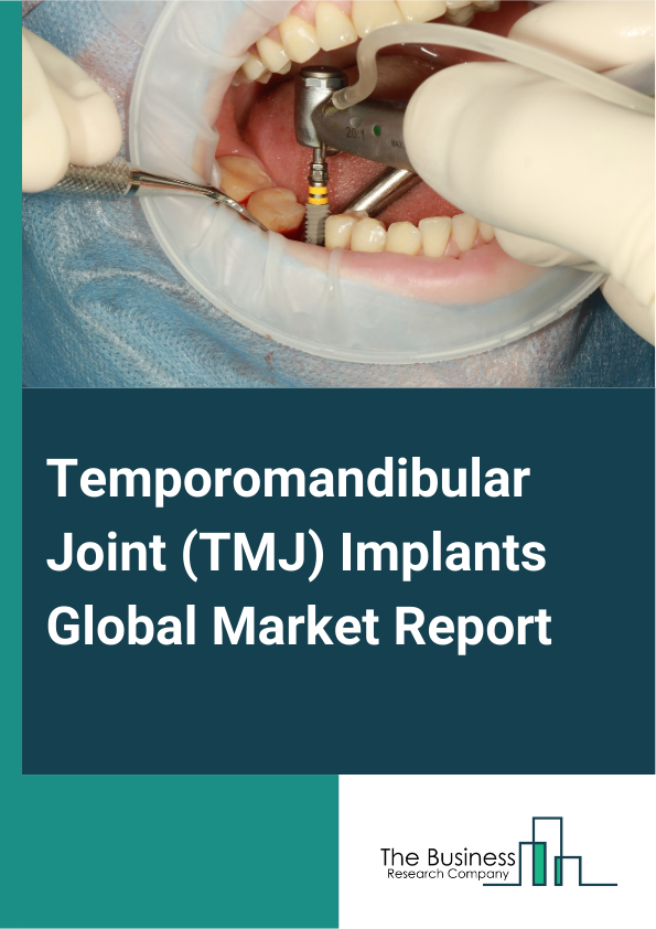 Global Temporomandibular Joint (TMJ) Implants Market Report 2025