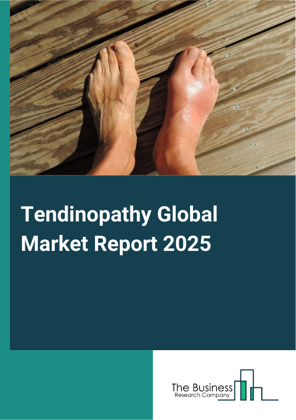 Global Tendinopathy Market Report 2025 