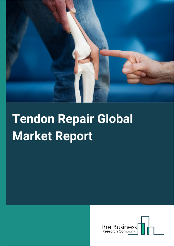 Global Tendon Repair Market Report 2025