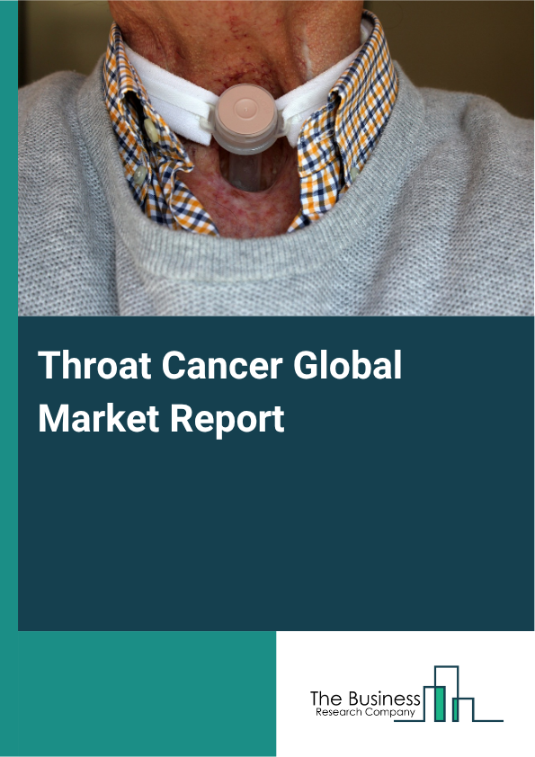 Global Throat Cancer Market Report 2025