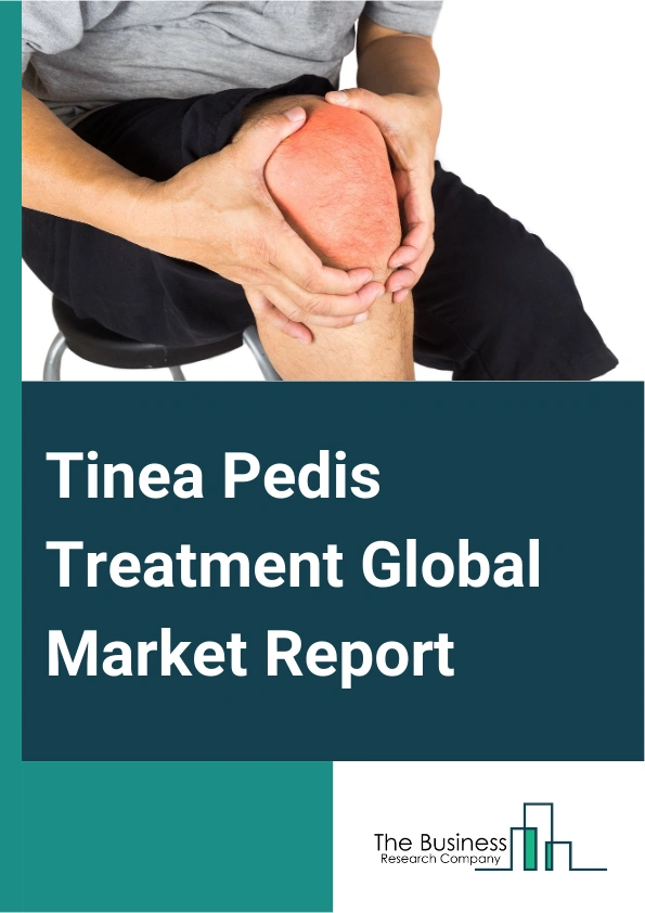 Global Tinea Pedis Treatment Market Report 2025