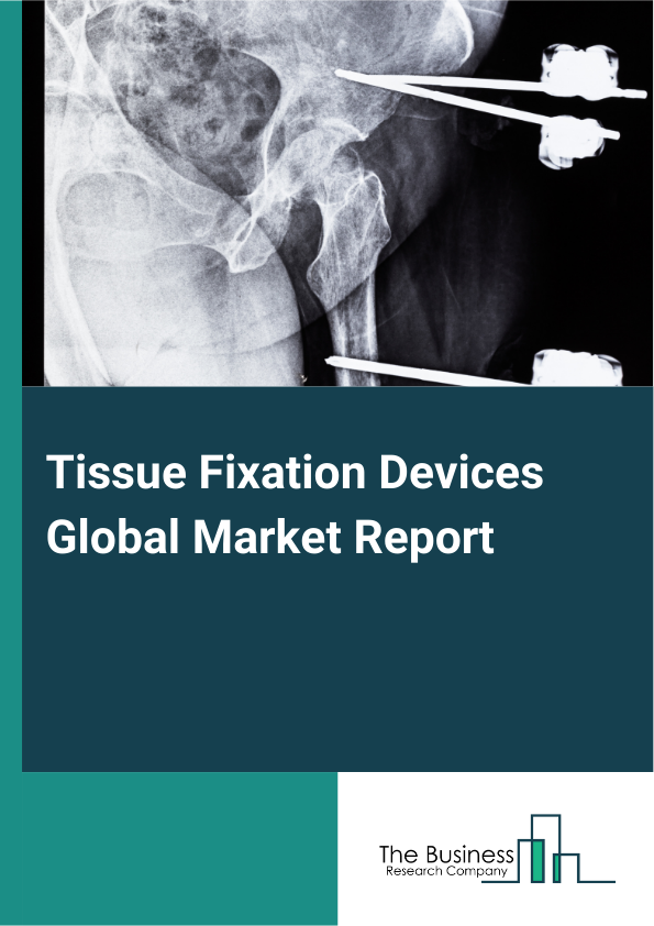 Tissue Fixation Devices