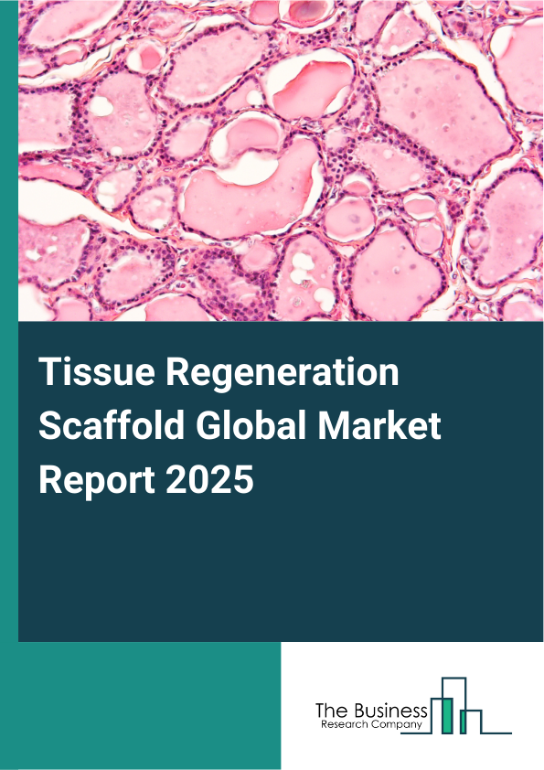 Global Tissue Regeneration Scaffold Market Report 2025