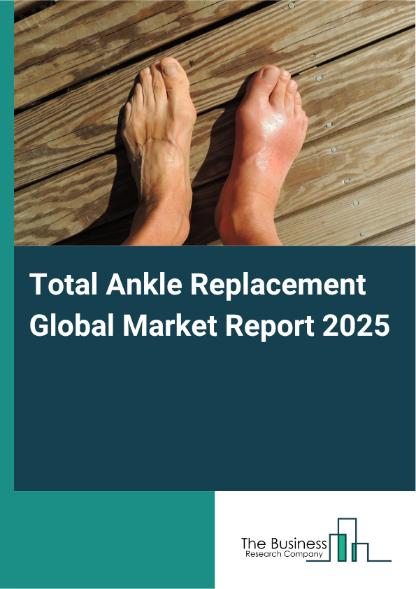 Global Total Ankle Replacement Market Report 2025