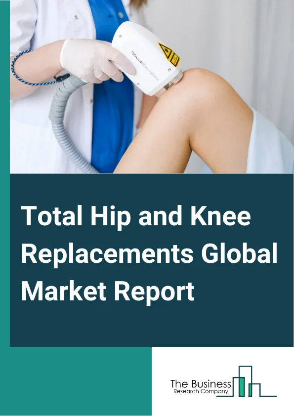 Total Hip and Knee Replacements Global Market Report 2025 – By Procedure Type (Total Hip Replacement, Partial Hip Replacement, Revision Hip Replacement, Total Knee Replacement, Partial Knee Replacement, Revision Knee Replacement), By Implant Type (Mobile Bearing, Fixed Bearing, Other Implant Types), By End-User (Hospitals, Ambulatory Surgical Centers, Orthopedic Clinics, Other End-Users) – Market Size, Trends, And Global Forecast 2025-2034