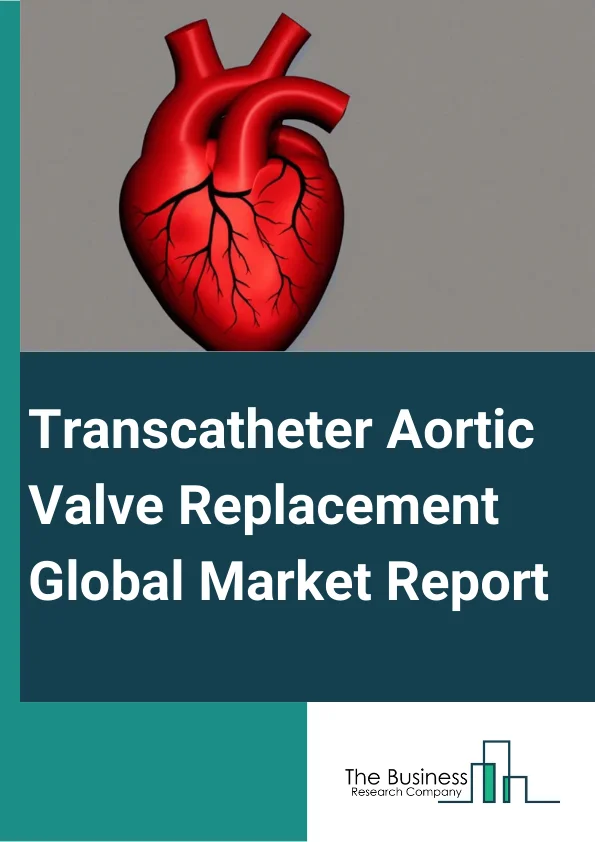 Transcatheter Aortic Valve Replacement Global Market Report 2024 – By Product (Self-Expandable Transcatheter Aortic Valves, Balloon-Expandable Transcatheter Aortic Valves, Mechanically Expanded Transcatheter Aortic Valves), By Material (Valve Frame Material, Valve Leaflet Material), By Procedure (Transfemoral Implantation, Transapical Implantation, Transaortic Implantation), By Application (Aortic Stenosis, Aortic Regurgitation, Other Applications), By End-User (Hospitals, Independent Cardiac Catheterization Labs, Ambulatory Surgical Centers, Other End-Users) – Market Size, Trends, And Global Forecast 2024-2033