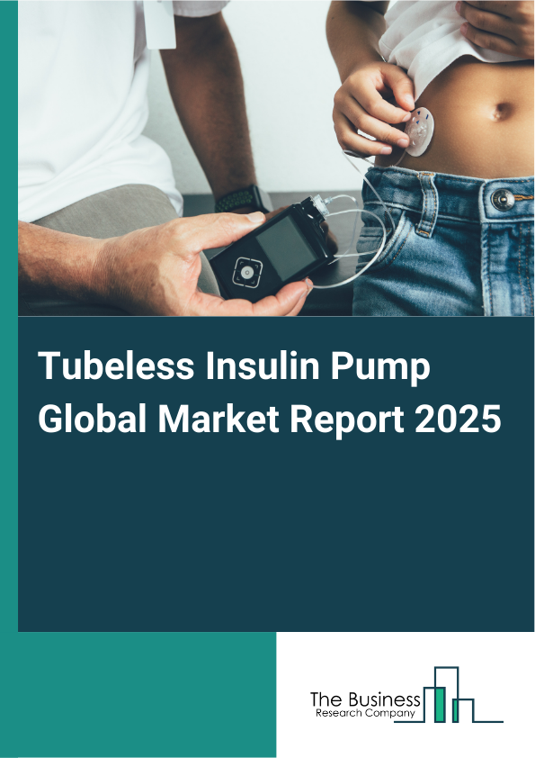 Global Tubeless Insulin Pump Market Report 2025