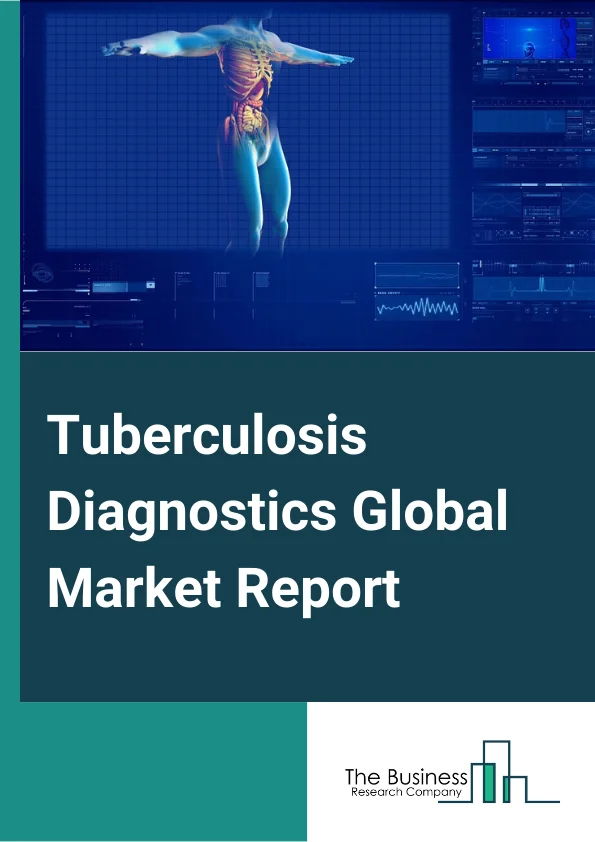 Tuberculosis Diagnostics Global Market Report 2024 – By Test Type (Radiographic Tests, Nucleic Acid Testing, Cytokine Detection Tests, Drug Resistance Tests, Skin Test / Mantoux Test (TST), Blood/Serology Test, Smear Microscopy Tests, Cell Culture-Based Tests, Other Test Types), By Disease Stage (Latent Tuberculosis, Active Tuberculosis), By End-User (Hospitals And Diagnostic Laboratories, Physician’s Office Laboratories, Reference Laboratories, Academics And Research Facilities) – Market Size, Trends, And Global Forecast 2024-2033