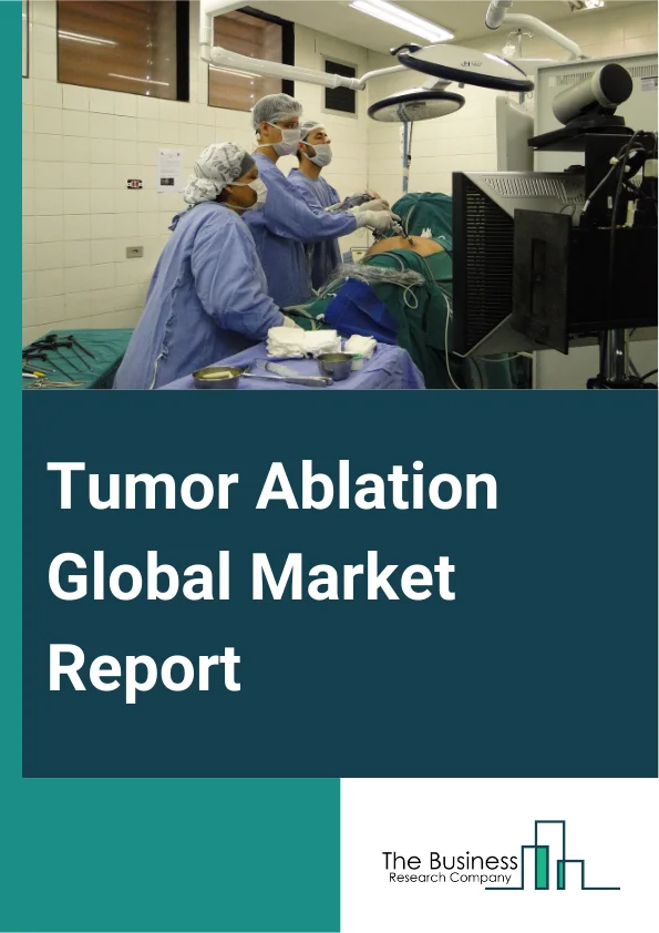 Tumor Ablation Global Market Report 2025 – By Type (Thermal Ablation, Chemical Ablation), By Types Of Treatment (Percutaneous, Laparoscopic, Surgical), By Application (Kidney Cancer, Liver Cancer, Breast Cancer, Lung Can...