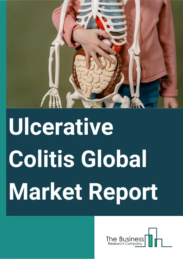Ulcerative Colitis Global Market Report 2023