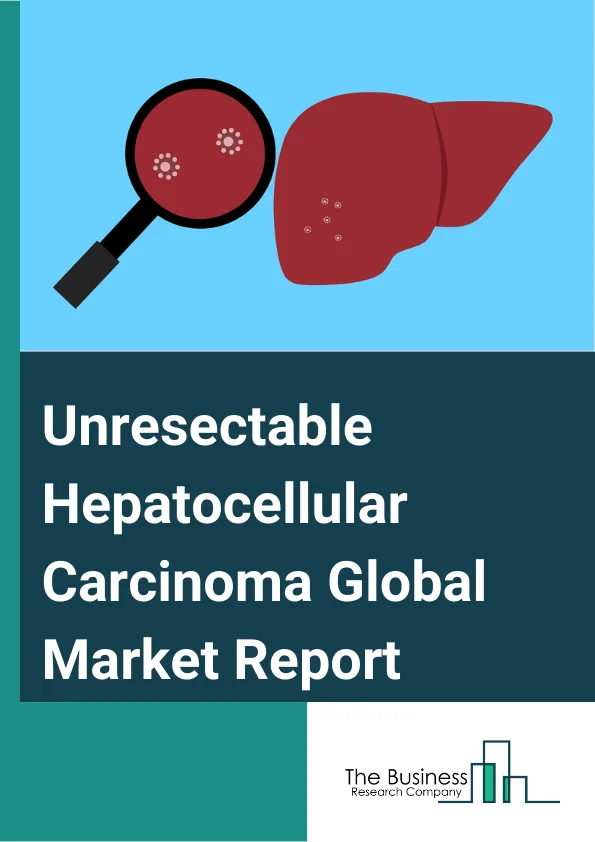 Unresectable Hepatocellular Carcinoma Global Market Report 2025 – By Type (Primary, Secondary, Benign Liver Growth), By Treatment Type (Chemotherapy, Molecularly Targeted Therapy, Immunotherapy, Other Treatments), By End-Users (Hospitals, Specialty Clinics, Cancer Centers) – Market Size, Trends, And Global Forecast 2025-2034