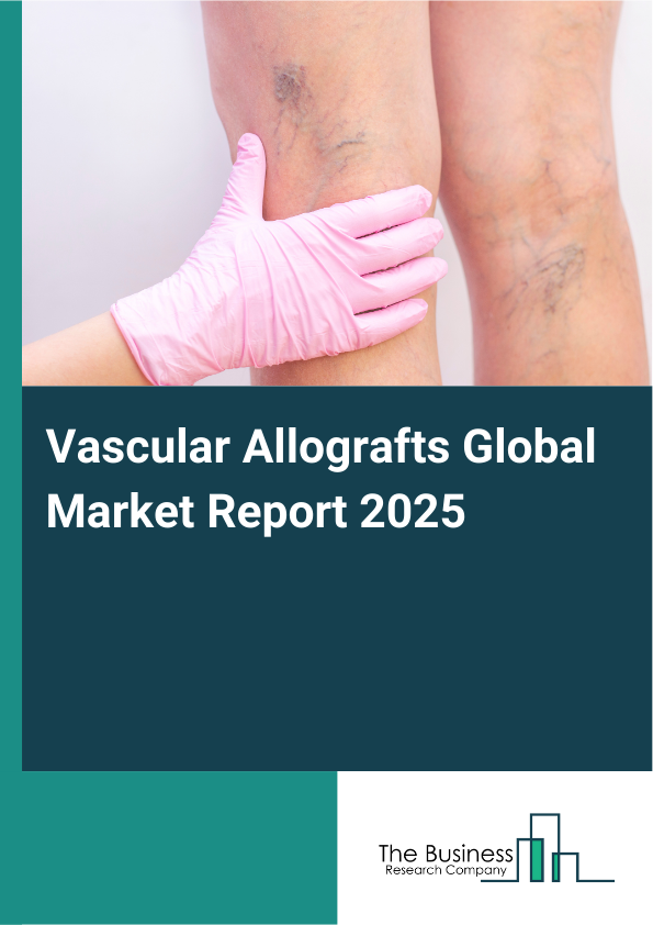 Global Vascular Allografts Market Report 2025