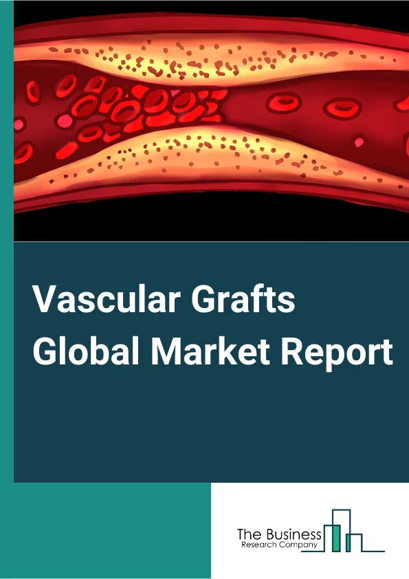 Vascular Grafts Global Market Report 2023 – By Product (Hemodialysis Access Graft, Endovascular Stent Graft, Peripheral Vascular Graft, Coronary Artery By-pass Graft), By Raw Material (Polyester Grafts, ePTFE, Polyurethane Grafts, Biosynthetic Grafts), By Application (Coronary Artery Disease, Aneurysm, Vascular Occlusion, Renal Failure), By End-User (Hospitals, Ambulatory Surgical Centers) – Market Size, Trends, And Global Forecast 2023-2032