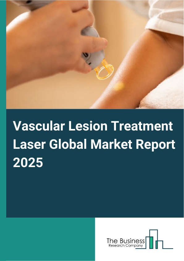 Global Vascular Lesion Treatment Laser Market Report 2025