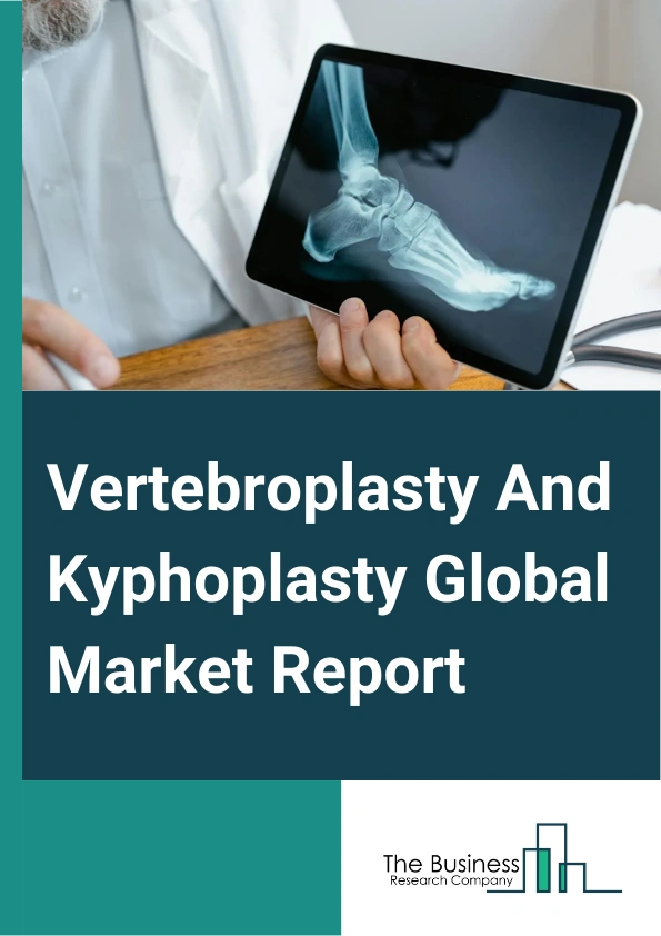 Vertebroplasty And Kyphoplasty
