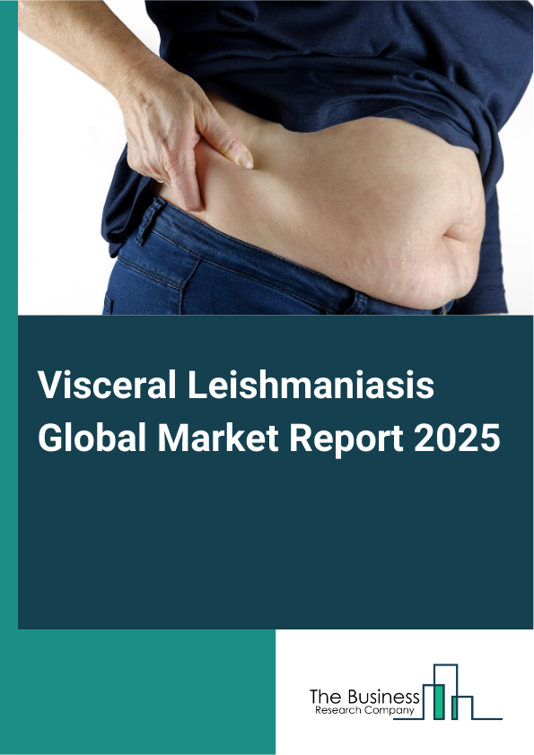 Global Visceral Leishmaniasis Market Report 2025